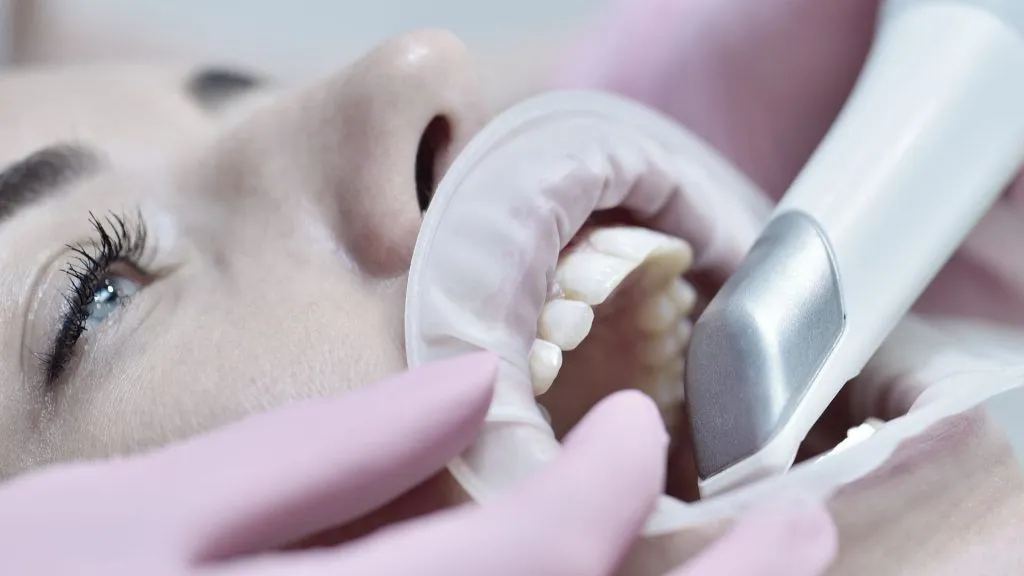 escaner-intraoral-demostracion-gratis