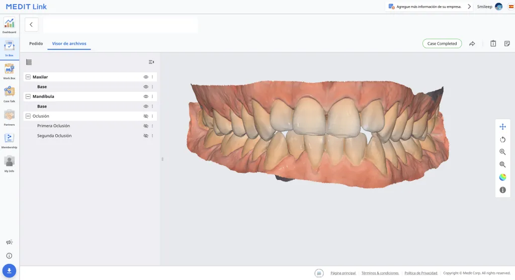 Ferula de descarga 3D