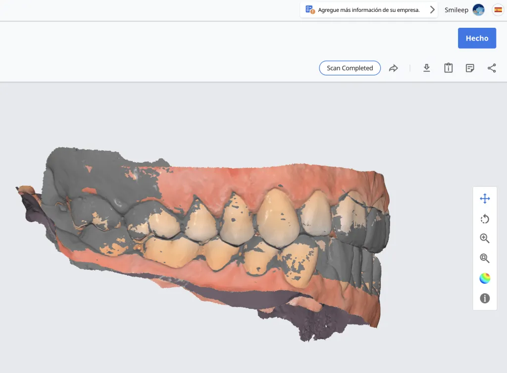 férula de descarga tipo michigan