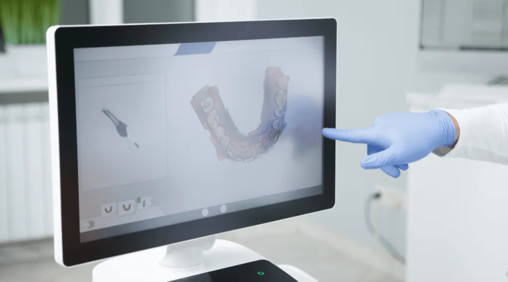 Escaner dental 3d