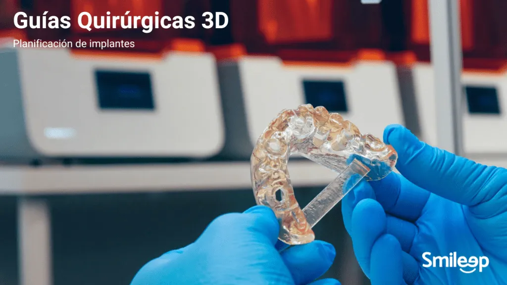 Guías Quirúrgicas 3D