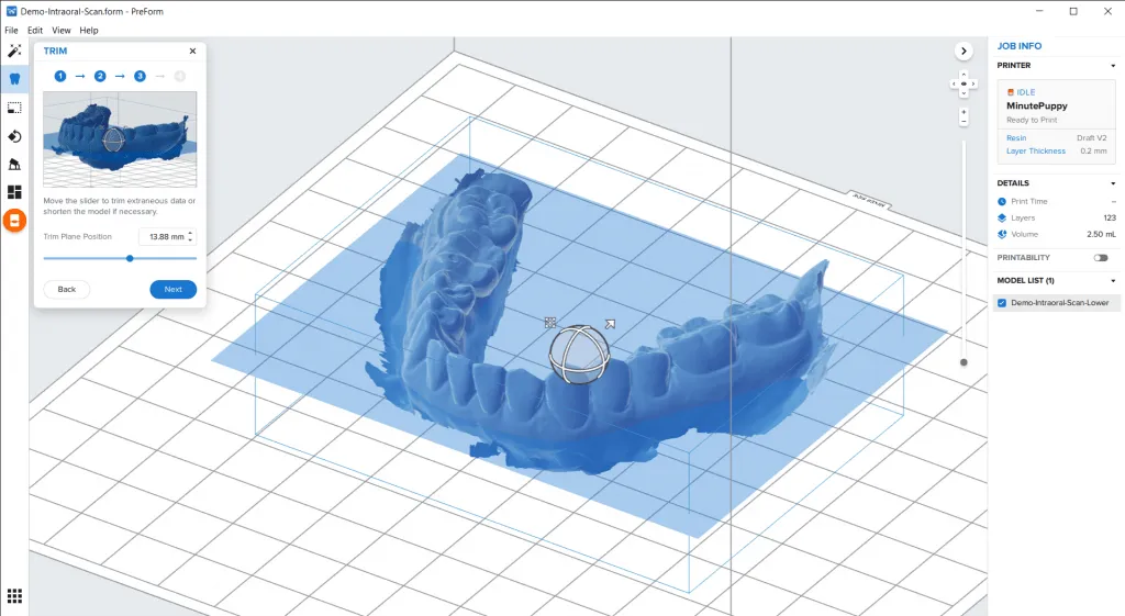 Modelos Dentales Digitales