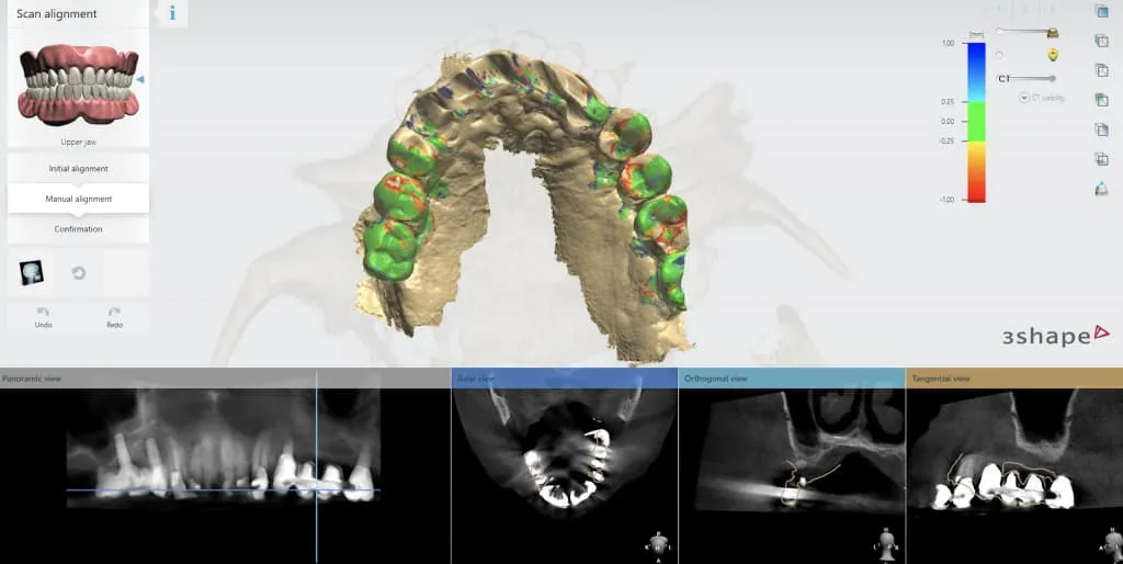 Guías Quirúrgicas 3D