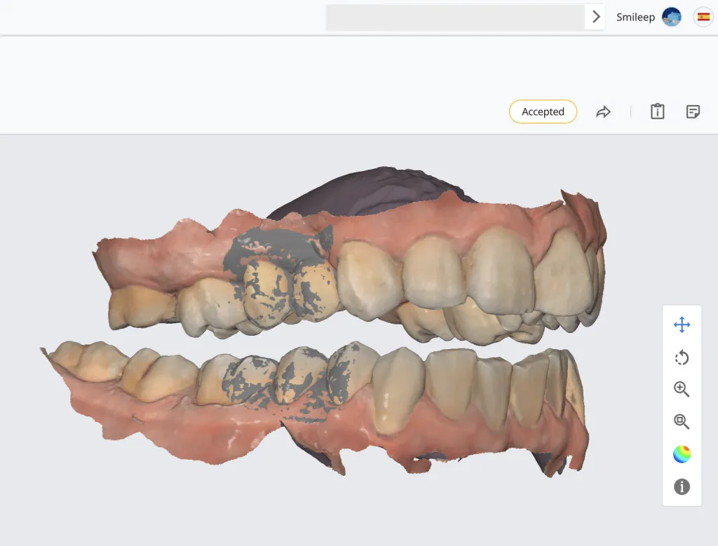 Escáner intraoral Medit