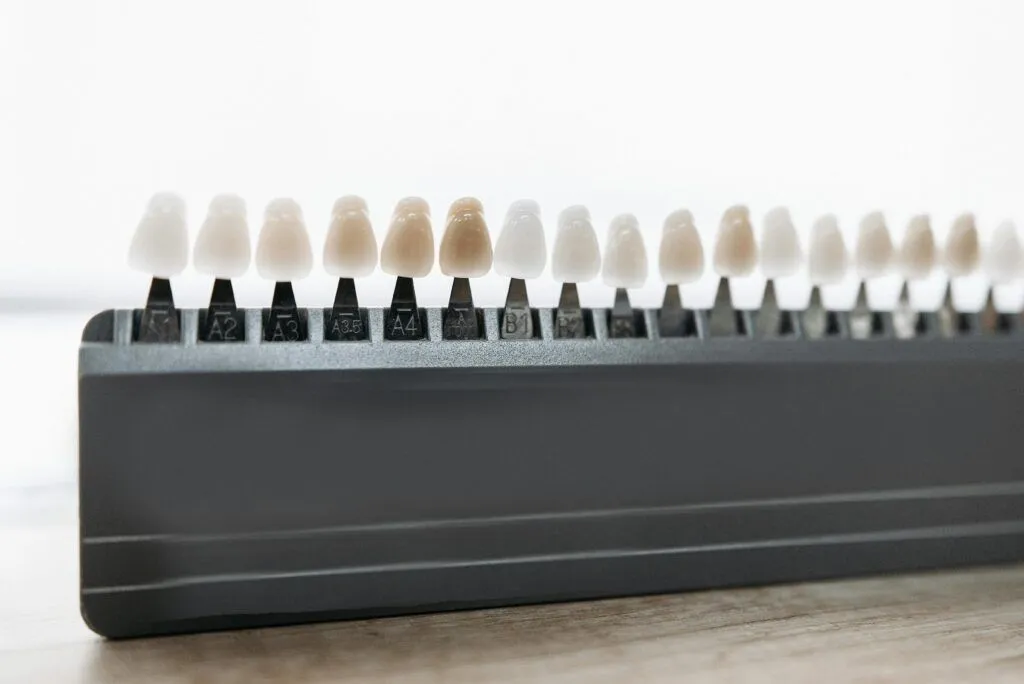 Prótesis Dental Sobre Implantes