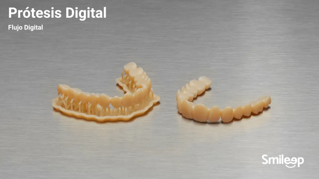 Prótesis dental 3D