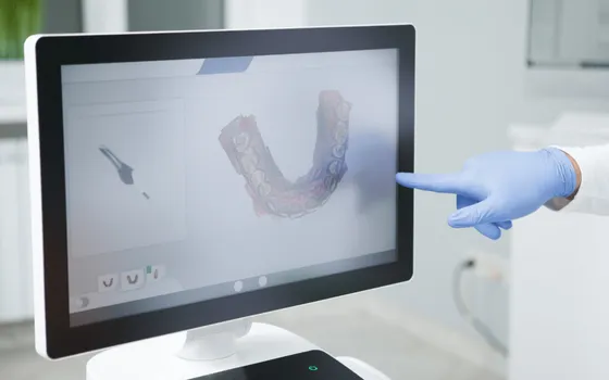 Escaner dental 3d