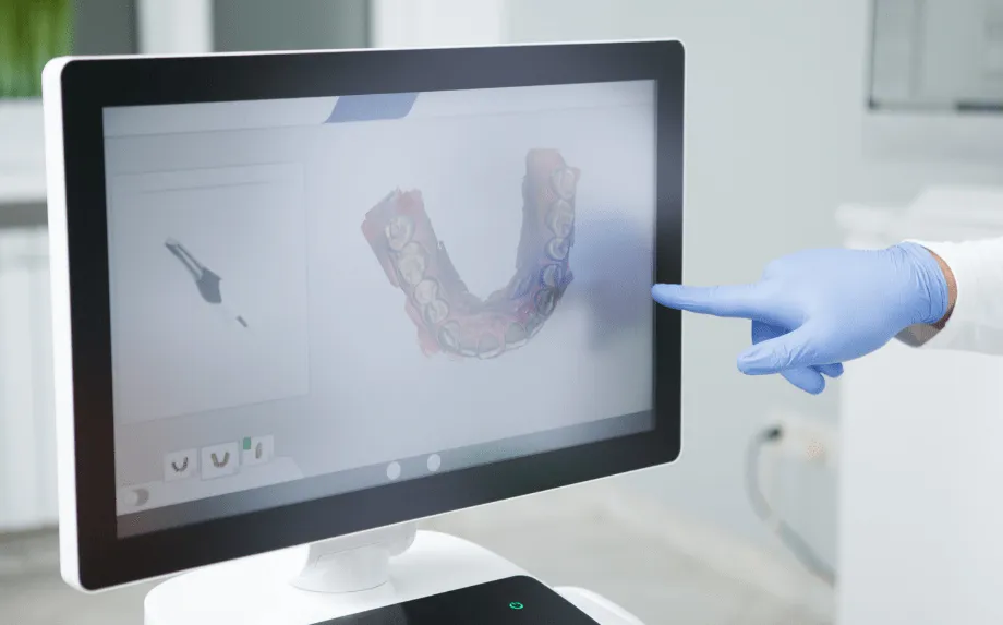 Escaner dental 3d