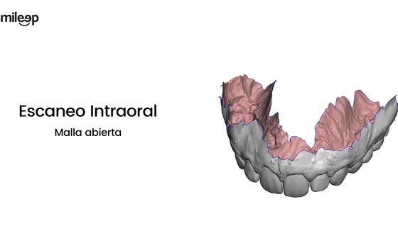 Meshmixer Dental tutorial para impresión 3D de modelos