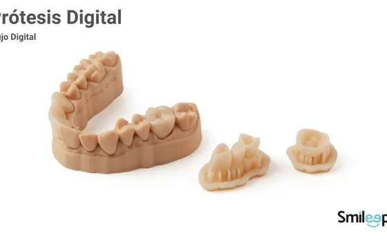 Prótesis Dentales: Tipos, Beneficios y Tecnología de impresión 3D