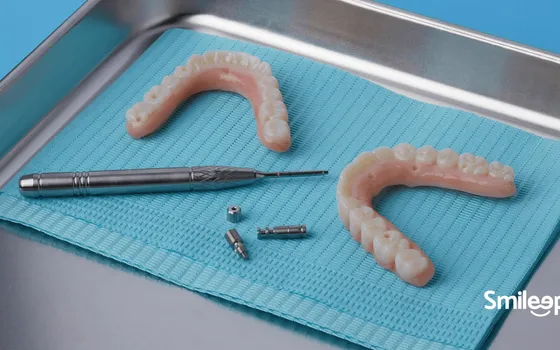 laboratorio dental en barcelona