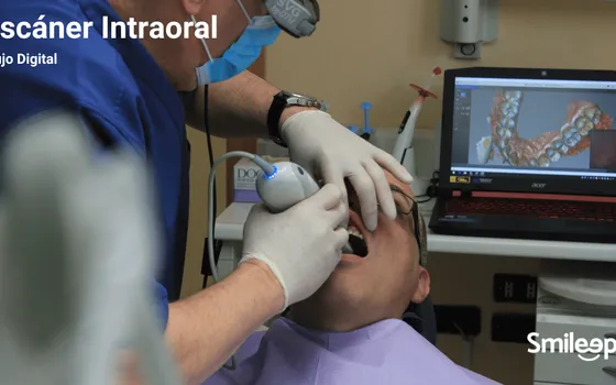Laboratorio Dental en Barcelona: Especialistas en Flujo Digital