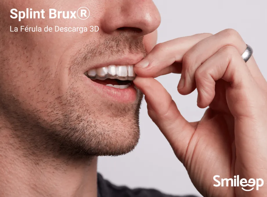 Férulas Bruxismo Digitales en 48 h: Precisión y Valor Clínico