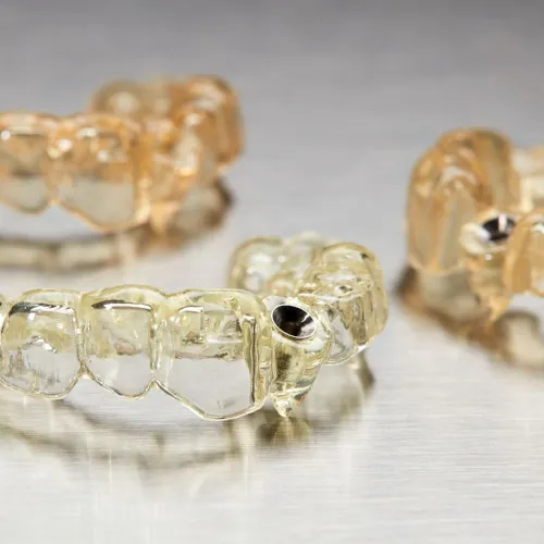 Guía quirúrgica 3D para implantes dentales impresa con tecnología digital