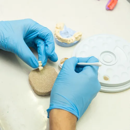 Prótesis dental fija diseñada para clínicas con flujo digital