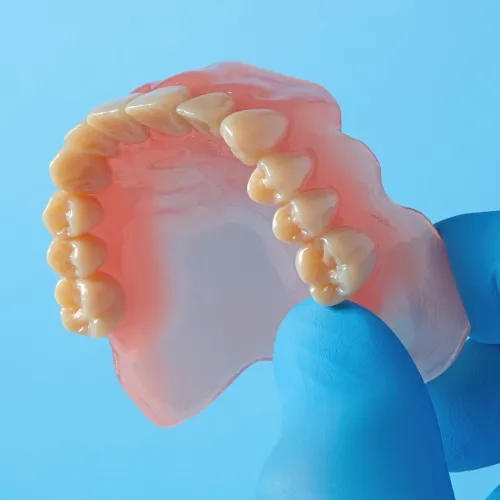 Prótesis removible fabricada con protocolo digital para clínicas dentales