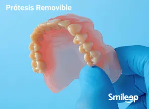 Prótesis Removible
