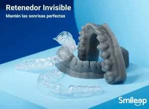 Retenedores Ortodoncia